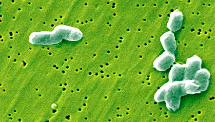 Бактерии Сальмонеллы под микроскопом
