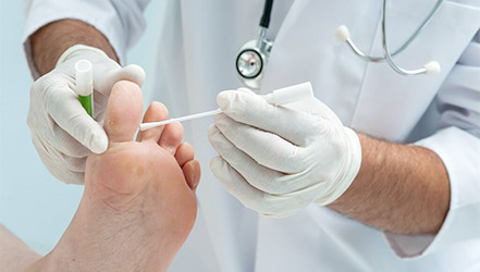 Доктор лечит грибок на ноге пациента
