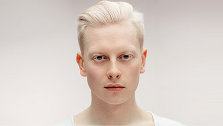 Парень альбинос
