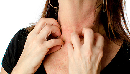 Девушка страдающая дерматитом чешет раздраженную шею