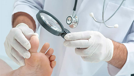 Доктор рассматривает грибок на ногах пациента