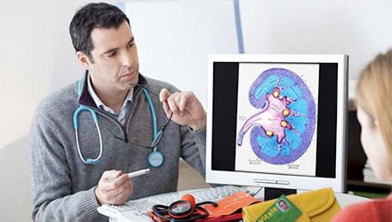 Доктор рассматривает снимок почки на компьютере