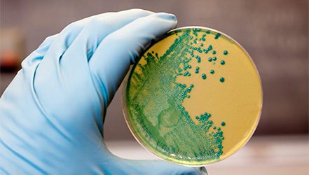 Бактерия Listeria