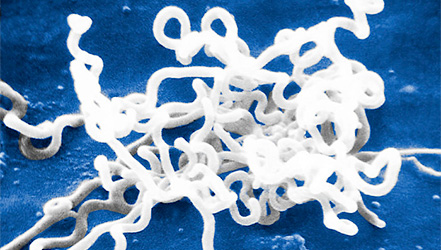 Бактерии сифилиса под микроскопом